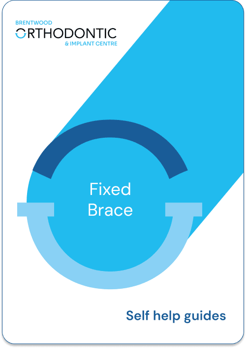Guide_Fixed Braces