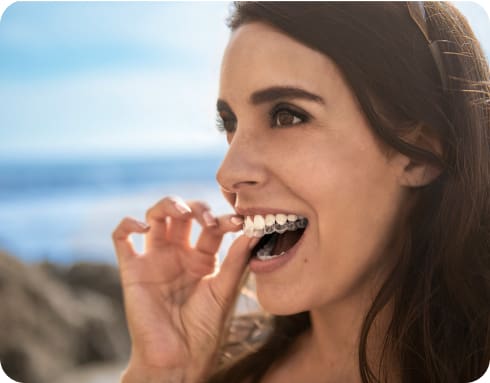 Invisalign for Adults 1