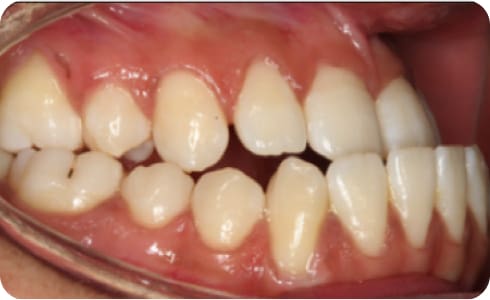 Orthognatic1