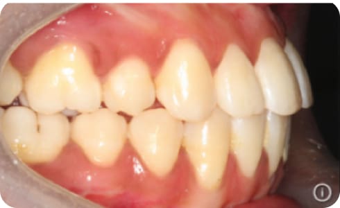 Orthognatic2